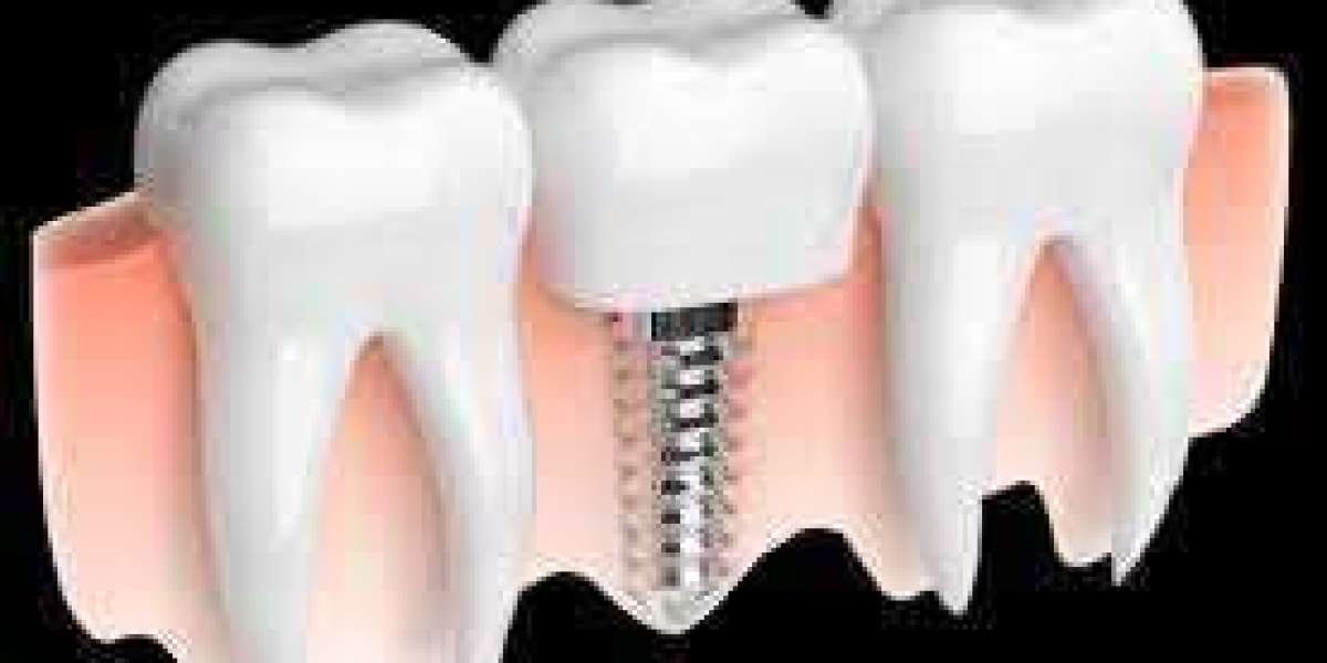 laser gum surgery near me