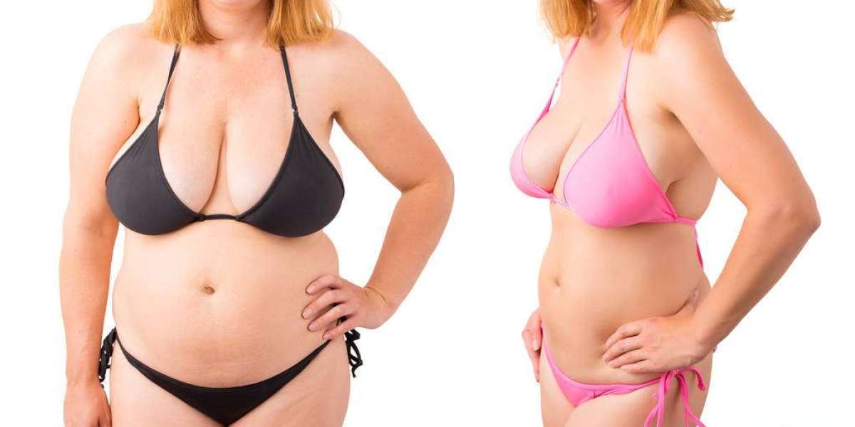 LipoVive Canada Black Friday Offer 50% Off Buy Now