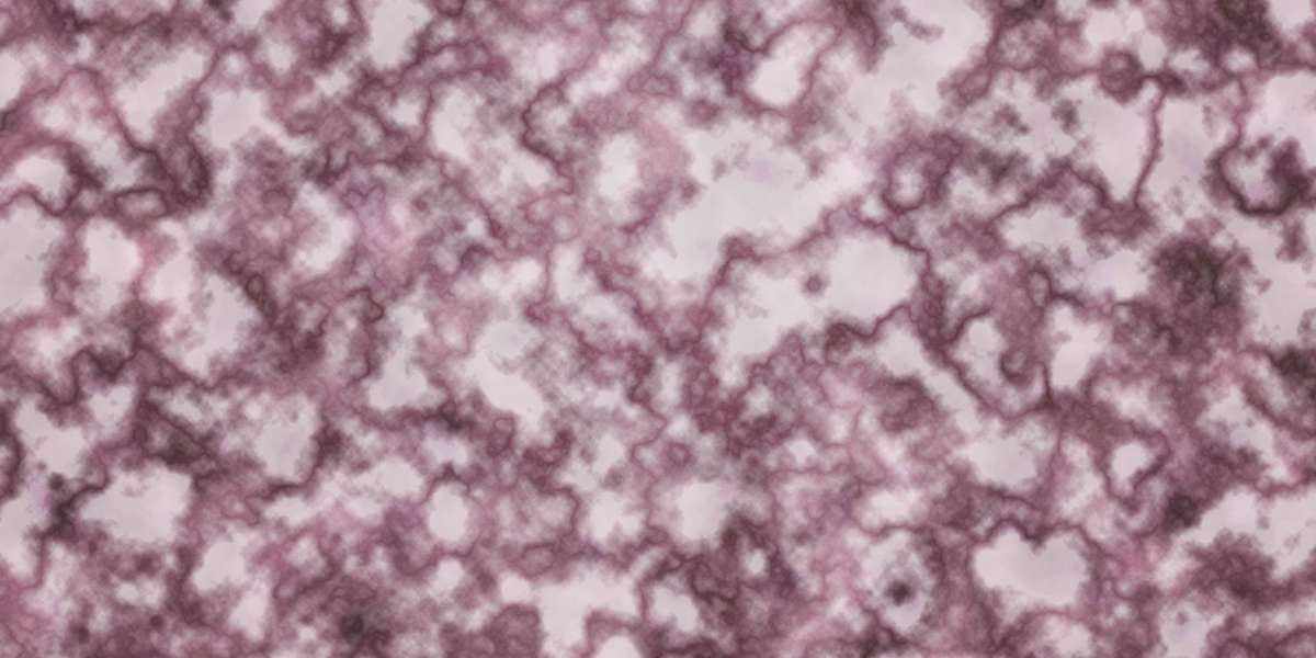 Developments in Gold IRA Kits: A Comprehensive Information To Modern Funding Solutions