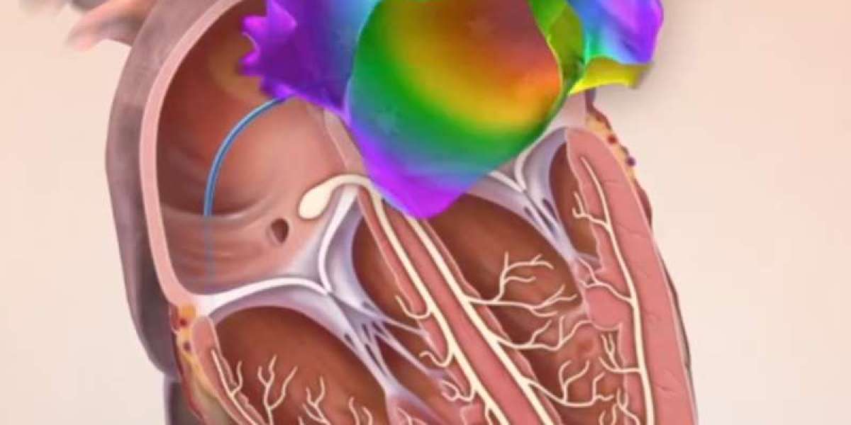 Electrophysiology Market Report: Unlocking Growth Potential and Addressing Challenges